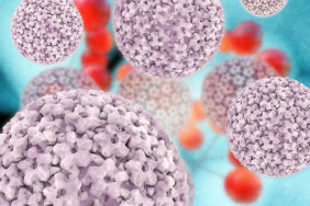 HPV et lésions intraépithéliales de bas grade