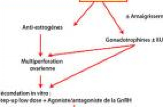 OPK : quand faut-il passer en FIV ? | Gynécologie Obstétrique Pratique